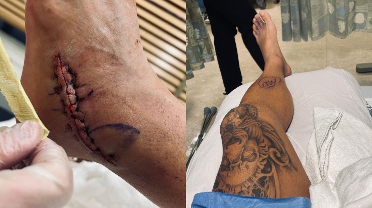 Fotografías publicadas por Ronald Matarrita en sus redes sociales