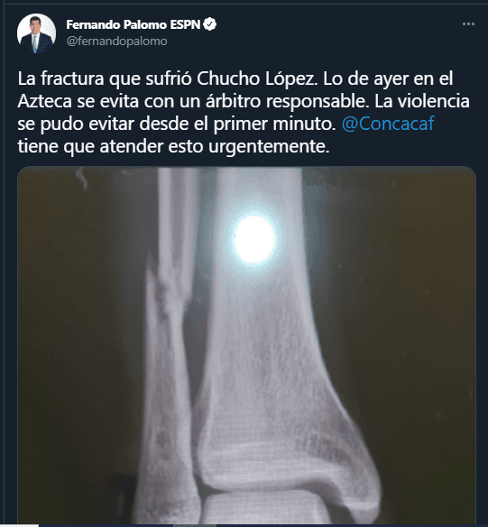 Periodistas se unen por la recuperación del Chucho López / Twitter Fernando Palomo